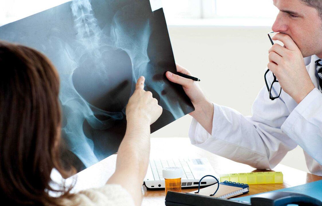 doctors taking x-rays for osteoarthritis of the hip